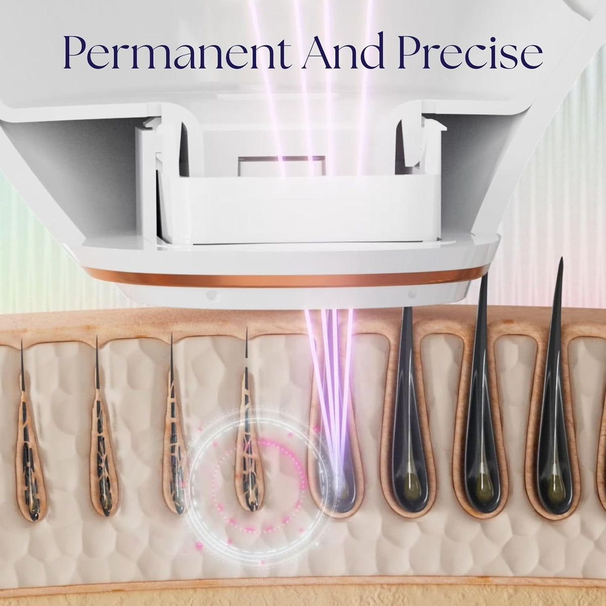 808 Laser Hair Removal Device | Smart Follicle Targeting | Epilaser